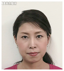 ビフォーアフターのイメージ