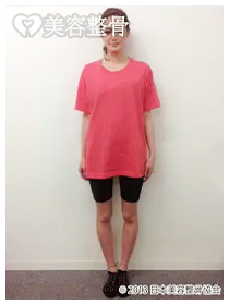 ビフォーアフターのイメージ