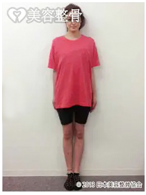 ビフォーアフターのイメージ