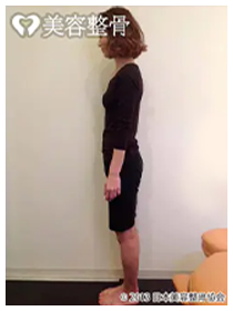 ビフォーアフターのイメージ