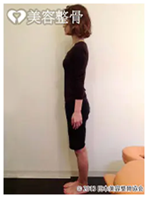 ビフォーアフターのイメージ